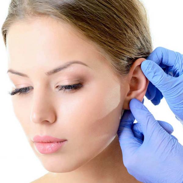 در مورد جراحی زیبایی گوش بیشتر بدانید + هزینه